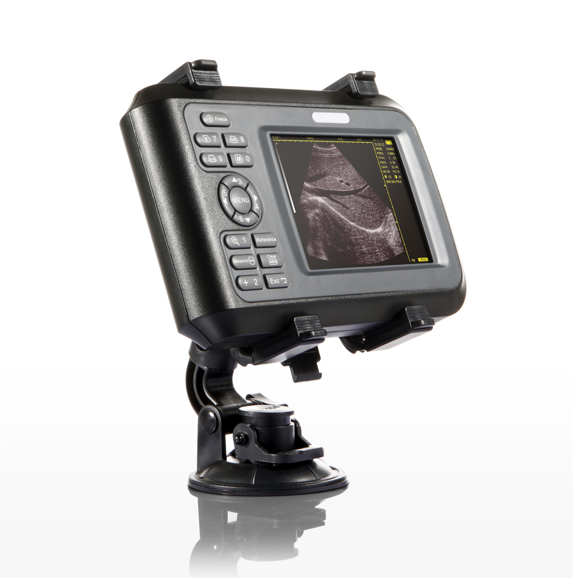 DP-20A Handheld B/W Ultrasound Scanner