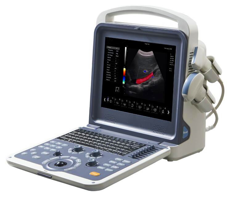 M5 Portable Color Doppler