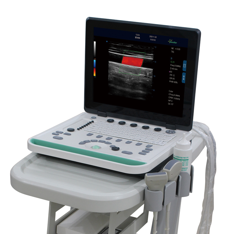 M6 Laoptop Color Doppler Ultrasound System