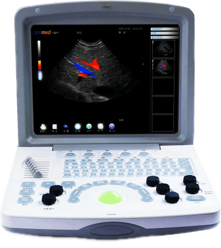 <b>Color Doppler M2</b>