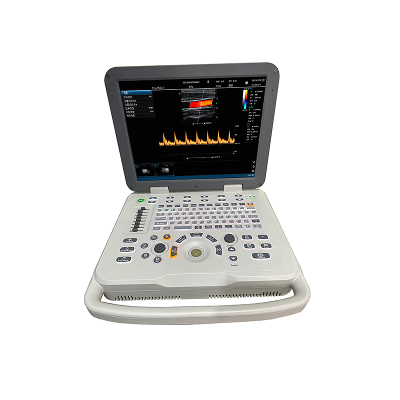 M6 PLUS Laptop Portable Color Doppler Ultrasound S